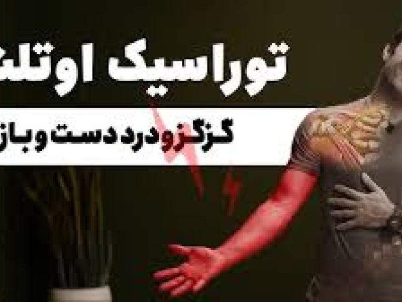 مشمولانی که دارای توراسیک اوت لت سندرم ( T.O.S ) باشند از سربازی معاف می شوند