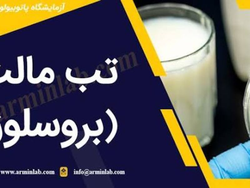 مشمولان مبتلا به بروسلوز از خدمت سربازی معاف می شوند