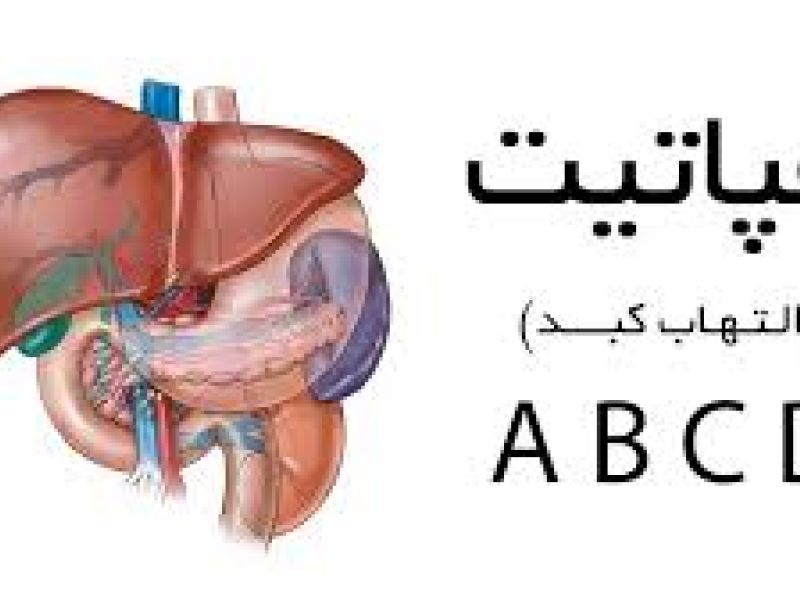مشممولان مبتلا به هپاتیت حاد از خدمت سربازی معاف می شوند.