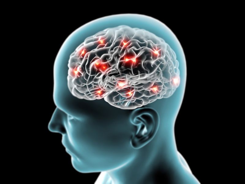 مشمولان مبتلا به اختلالات سلولهای عصبی از سربازی معاف می شوند